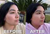 Bounceback | Triple Peptide Collagen Boosting Serum for Wrinkles & Acne Scars