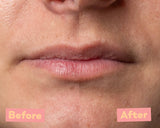 Lip Peeling AHA 5% & Marine BHA – Gentle Exfoliating Lip Treatment