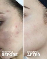 Jelly Drops | Hydrating Glow Serum with Tremella Mushroom & Vitamin C | Lightweight Jelly Serum