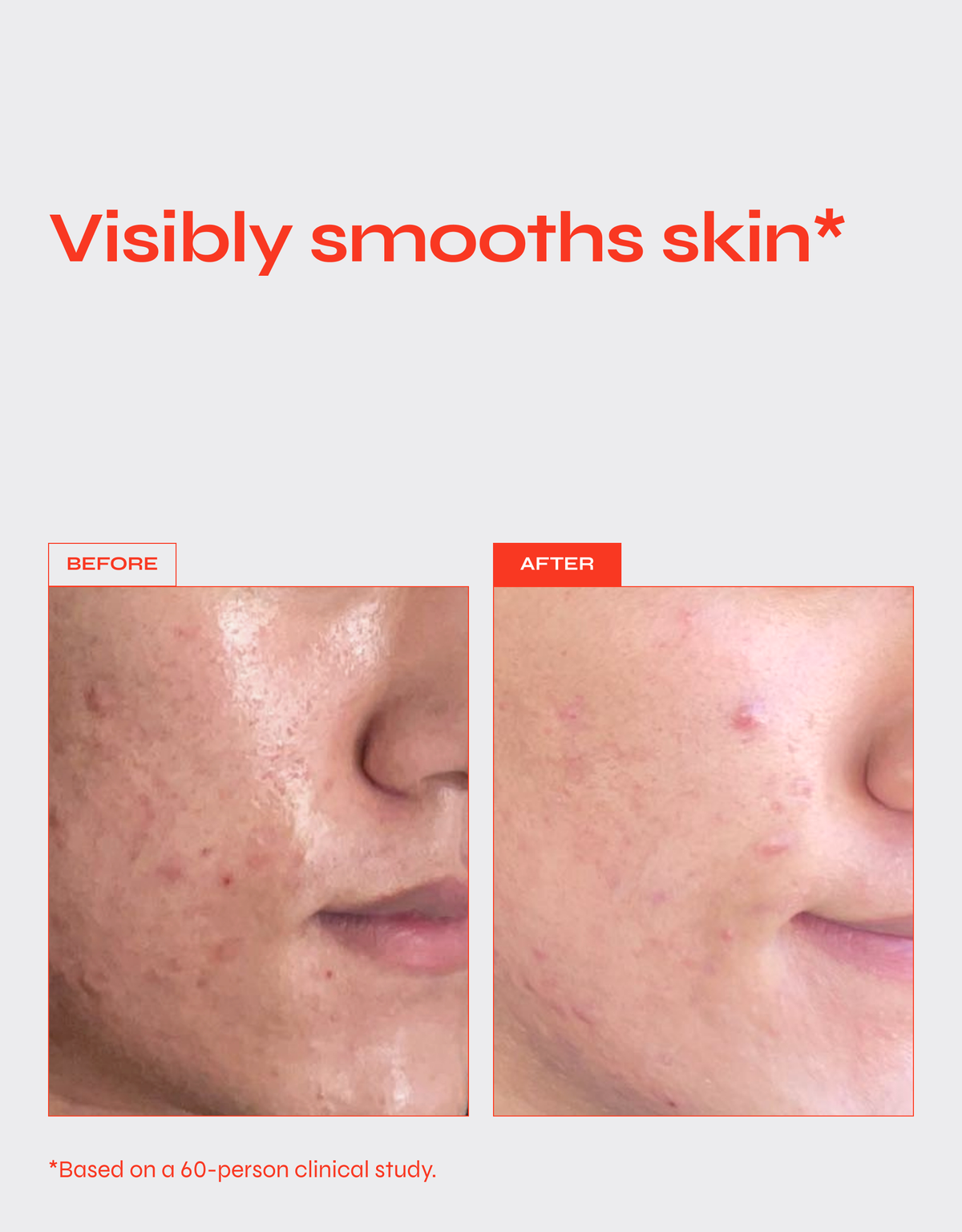 Reverse | Retinol + Vitamin C Serum