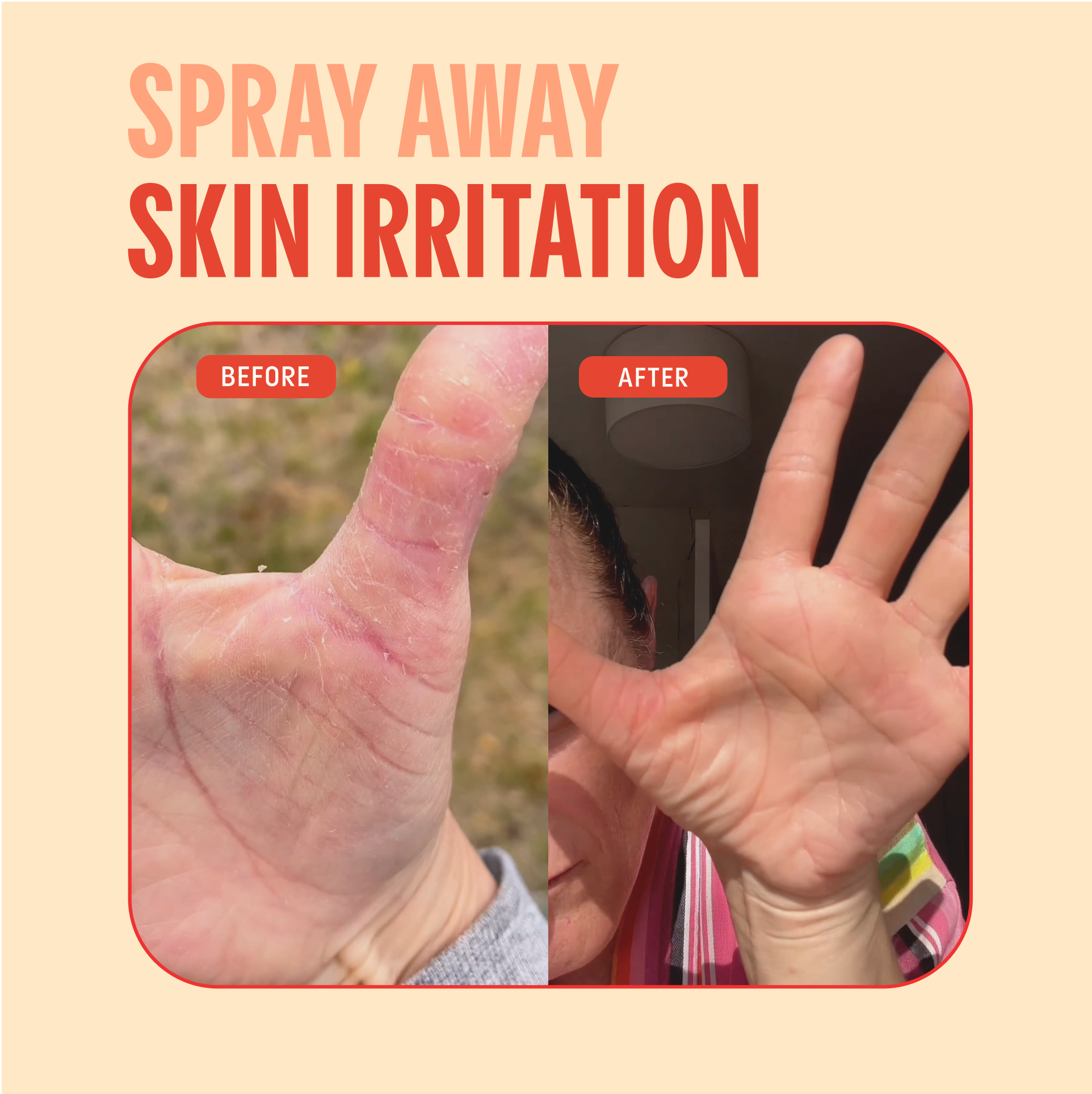 Mighty Mist Clear Skin Spray | Hypochlorous Acid Facial Spray for Acne, Eczema, Rosacea
