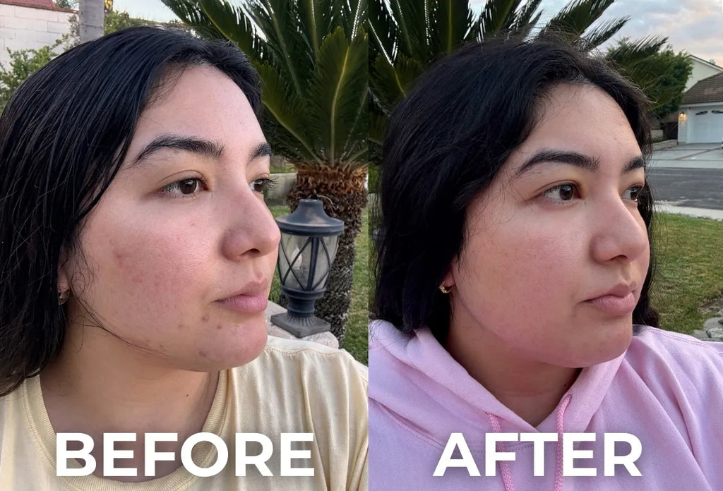 Bounceback | Triple Peptide Collagen Boosting Serum for Wrinkles & Acne Scars