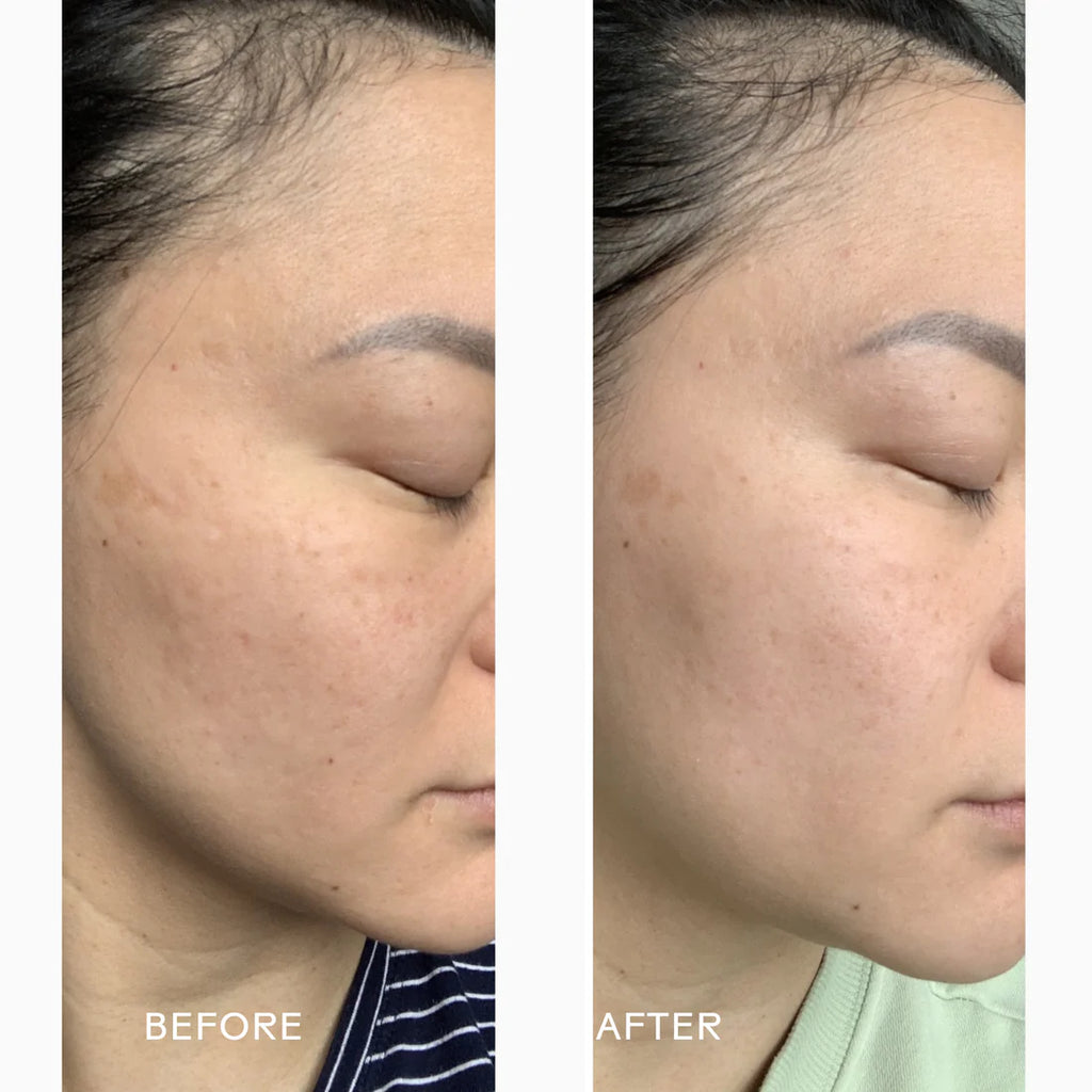 Radiance | Glow-Boosting Antioxidant Moisturizer | Lightweight Radiance Face Cream