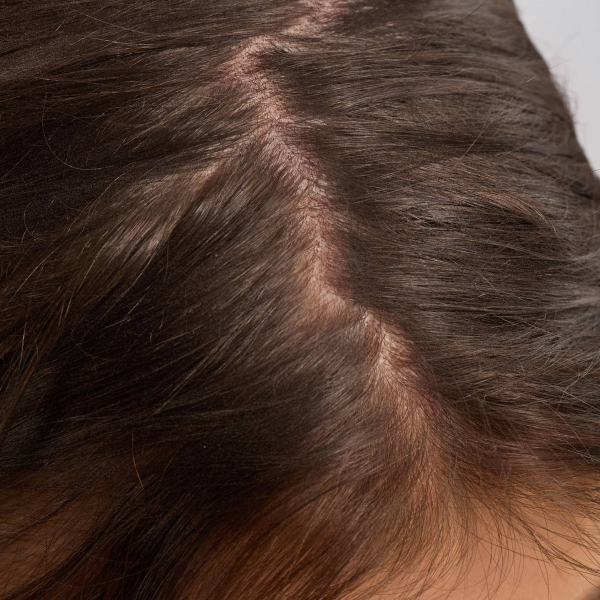 Rosemary & Biotin Strengthening Hair & Scalp Oil