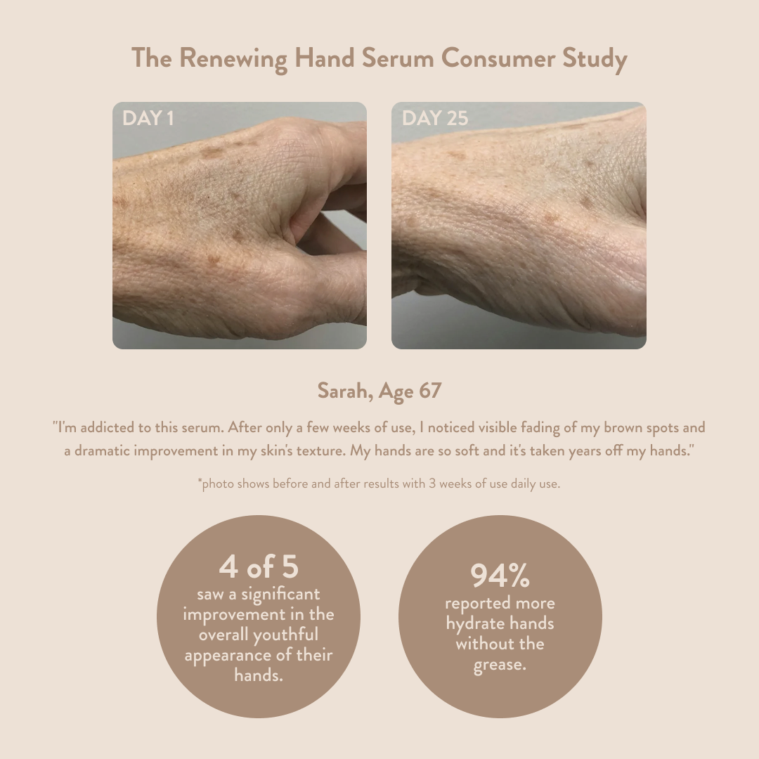 Anti-Aging Hand Serum for Wrinkles, Dark Spots + Crepey Skin