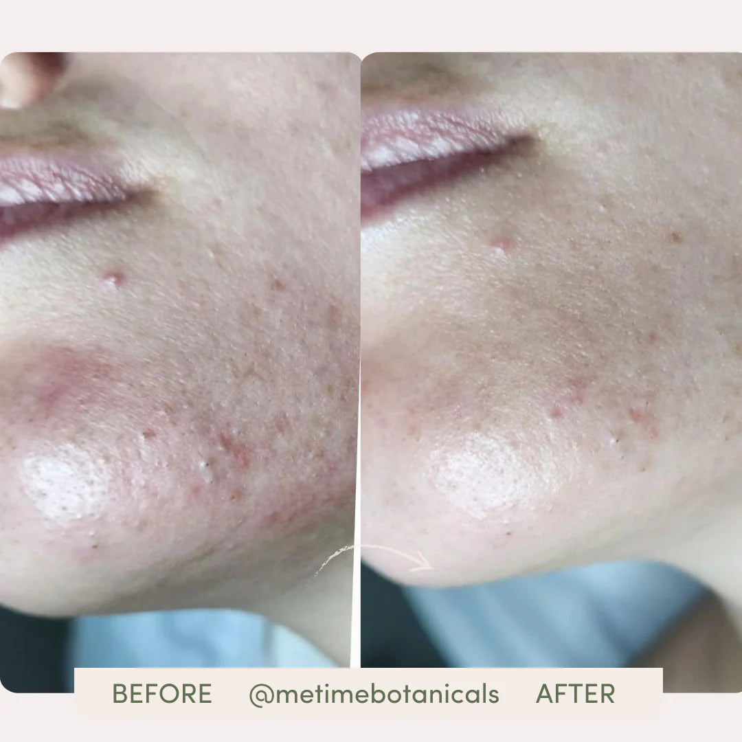 Glow Getter Blemish-Free Hydration Serum | All-in-One Serum + Moisturizer