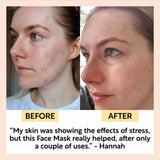 Kaolin Clay Face Mask