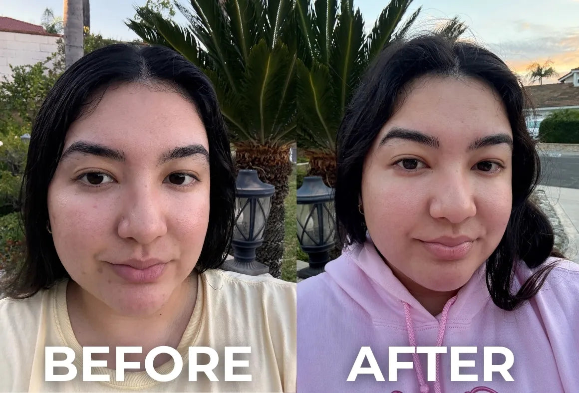 Bounceback | Triple Peptide Collagen Boosting Serum for Wrinkles & Acne Scars