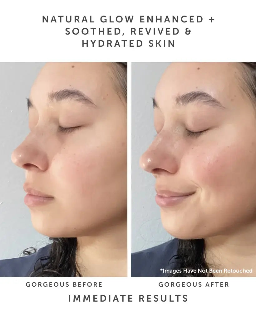 TREASURE | Barrier Boost Glazing Milk Serum