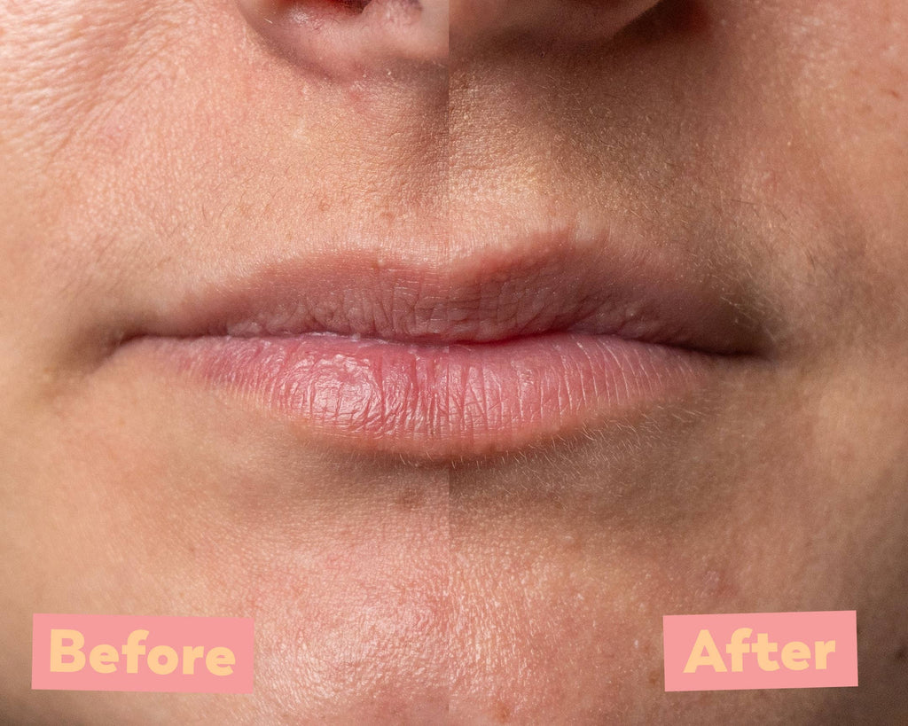 Lip Peeling AHA 5% & Marine BHA – Gentle Exfoliating Lip Treatment