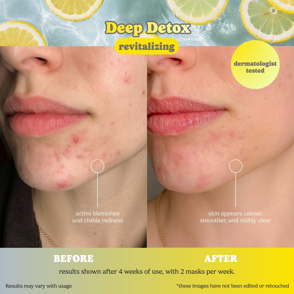 Charcoal Detox Sheet Mask