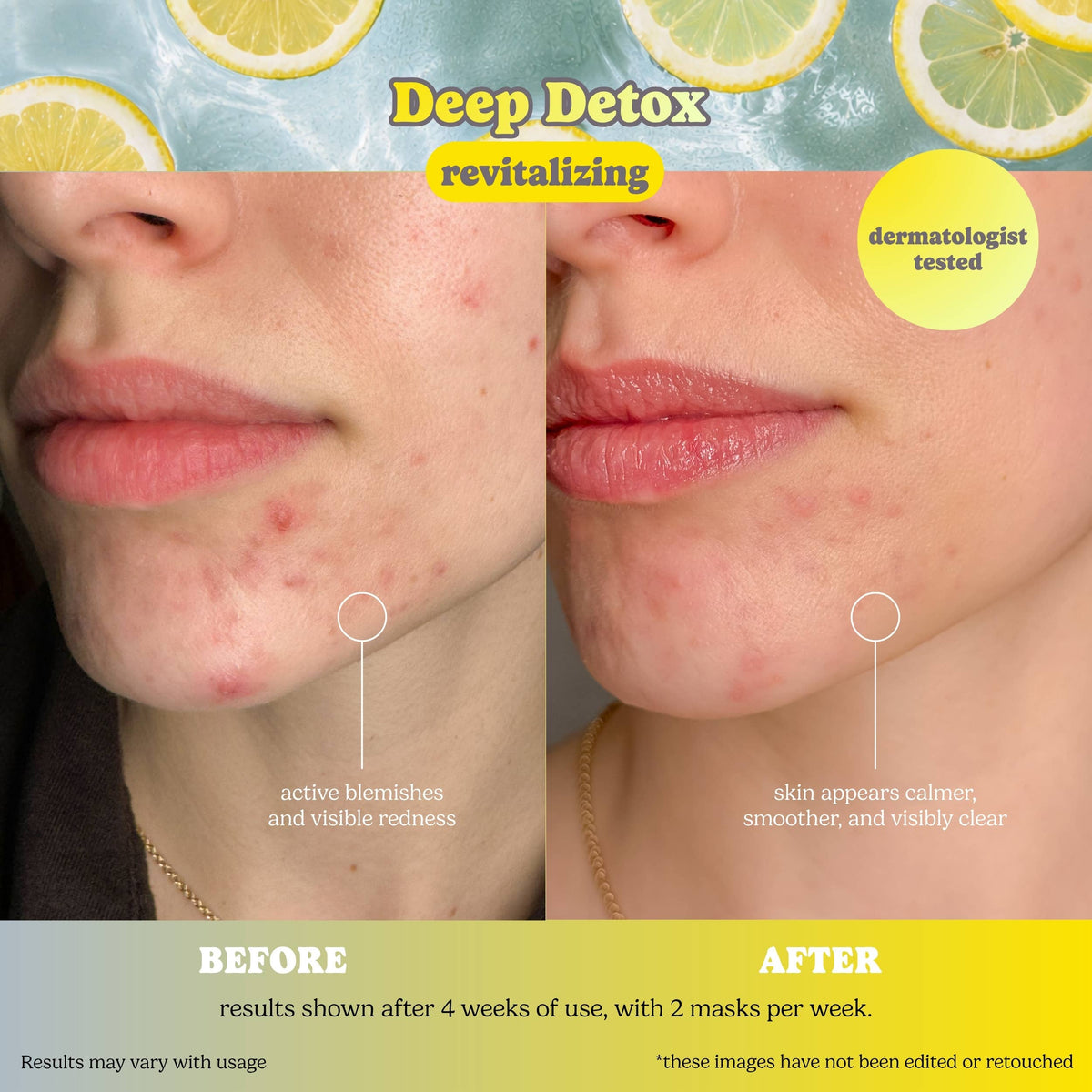 Charcoal Detox Sheet Mask