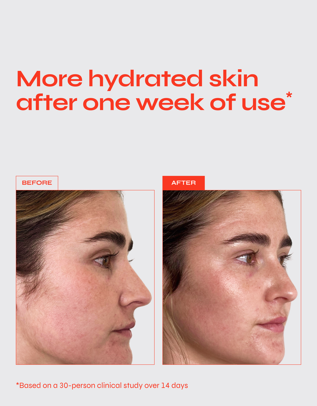 Barely There | Hyaluronic Acid Lightweight Moisturizer
