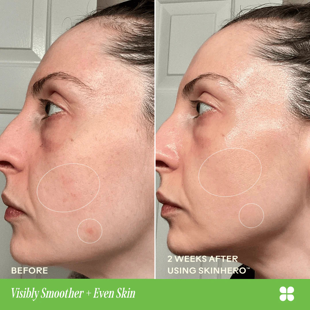 SkinHero™ Calendula + 2% Bakuchiol Bio-Retinol Serum