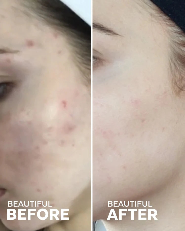 Jelly Drops | Hydrating Glow Serum with Tremella Mushroom & Vitamin C | Lightweight Jelly Serum