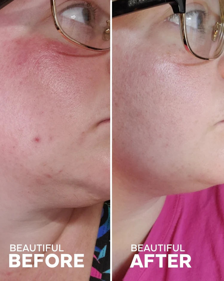 Radiance | Glow-Boosting Antioxidant Moisturizer | Lightweight Radiance Face Cream